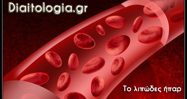 λιπώδες ήπαρ