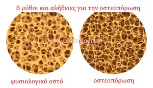 8 μύθοι και αλήθειες για την οστεοπόρωση