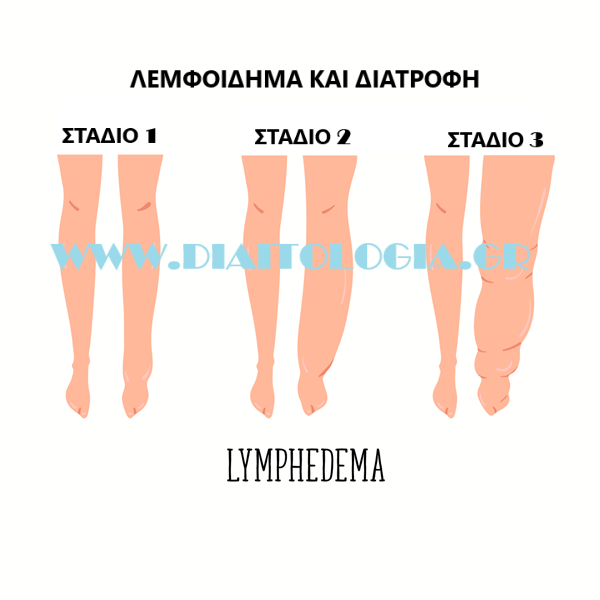 Λεμφοίδημα και διατροφή